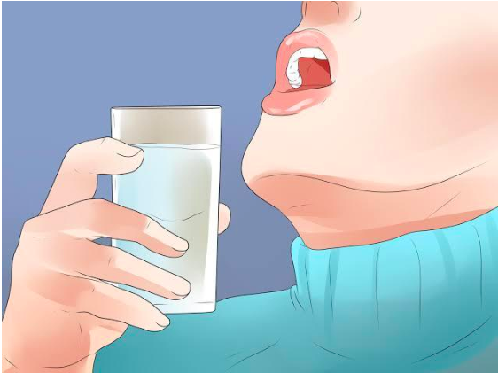 Mouth Ulcers