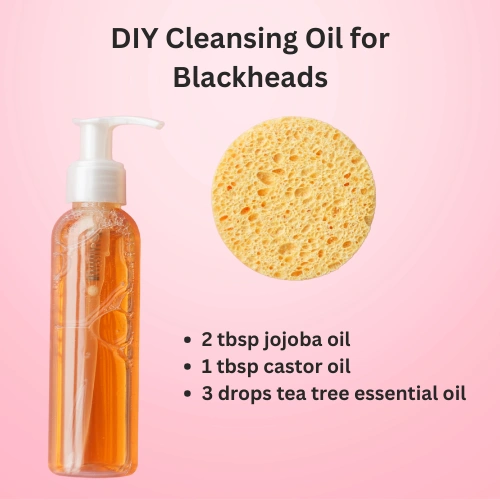 Get Rid of Blackheads