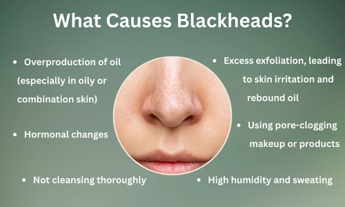 Get Rid of Blackheads